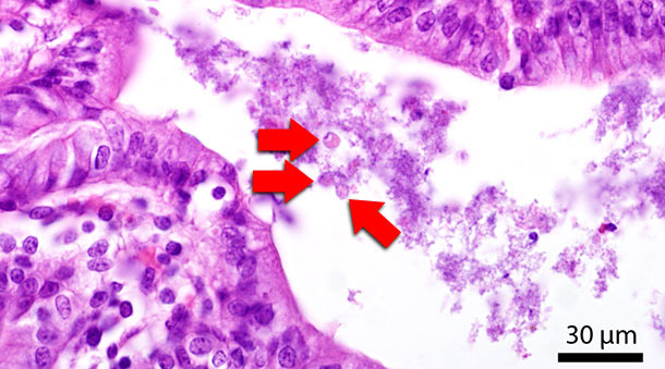 Histologischer Schnitt des Dickdarms. Die roten Pfeile zeigen auf Blastocystis-Stadien im Darmlumen