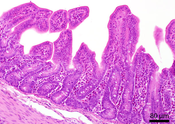 Histologischer Schnitt eines Dünndarms. In der Mukosa sind zahlreiche eosinophile Granulozyten zu sehen