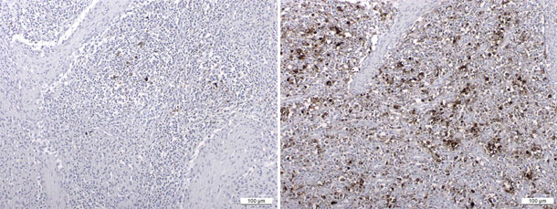 Mittels Immunhistochemie nachgewiesenes PCV-2 Antigen t 1