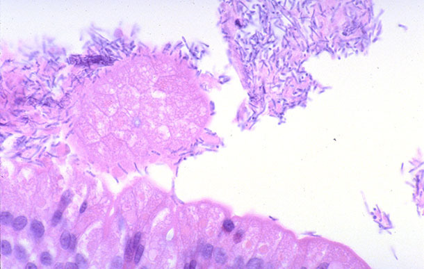Dünndarm eines Ferkels mit Durchfall einhergehend mit einer Infektion durch Clostridium perfringens Typ A.