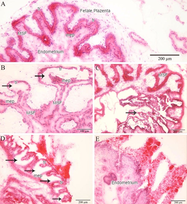 Histopathologische Untersuchung des Endometriums und der Plazenta