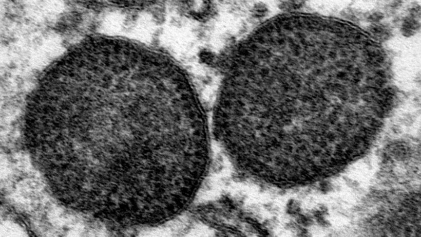 Elektronenmikroskopische Aufnahme von zwei Einschlussk&ouml;rperchen im Zytoplasma eines Makrophagen, einschlie&szlig;lich einer sehr hohen Anzahl an PCV2-Partikeln. 150.000x. Quelle: Carolina Rodr&iacute;guez-Cari&ntilde;o, CReSA
