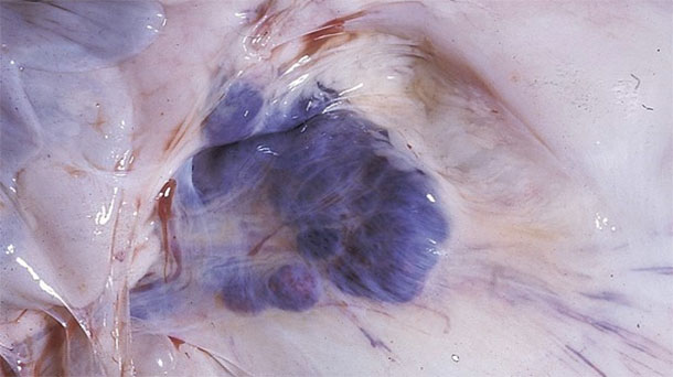 Abbildung 6: Sektionsbefunde bei betroffenen Schweinen. Man beachte die Blutungen in den Mesenteriallymphknoten.
