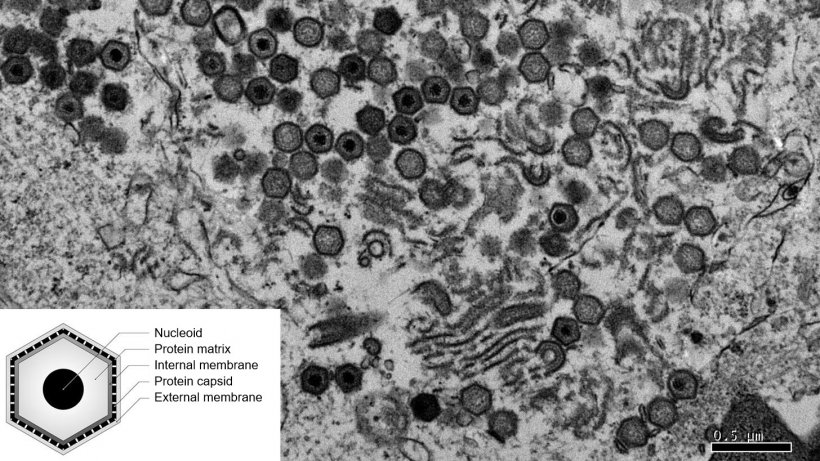 Elektronenmikroskopisches Bild einer vom ASP-Virus infizierten Zelle.
