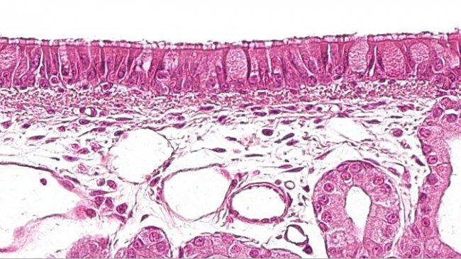 Abbildung 1: F&uuml;r den Atemtrakt charakteristisches pseudostratifiziertes Flimmerepithel mit Becherzellen
