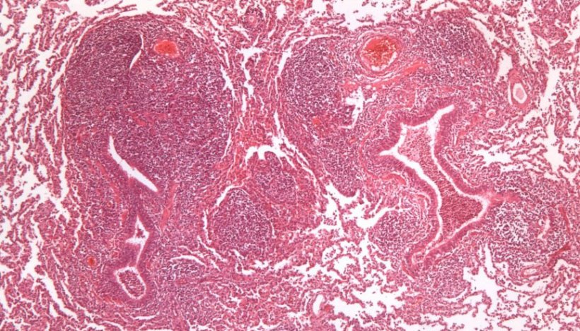 Abbildung 2: Hyperplasie von peribronchiol&auml;rem lymphatischem Gewebe, verursacht durch M. hyopneumoniae
