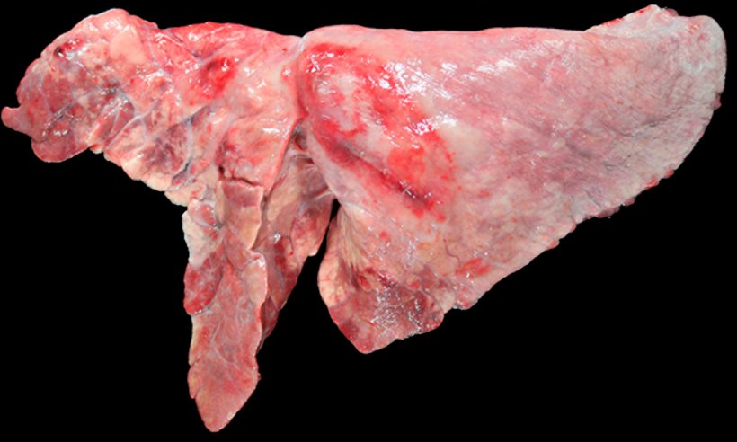 Abbildung 5: Mit M. hyopneumoniae und A. pleuropneumoniae koinfizierte Lunge eines Schweins.&nbsp; Kranioventrale konsolidierte Bereiche mit r&ouml;tlich-brauner F&auml;rbung, verursacht durch eine Infektion mit M. hyopneumoniae, und eine ovalf&ouml;rmige L&auml;sion mit pleuraler Fibrose und h&auml;morrhagischem Bereich im Zwerchfelllappen, was zum chronischen Stadium nach Auftreten einer durch A. pleuropneumoniae verursachten Nekrose passen w&uuml;rde.
