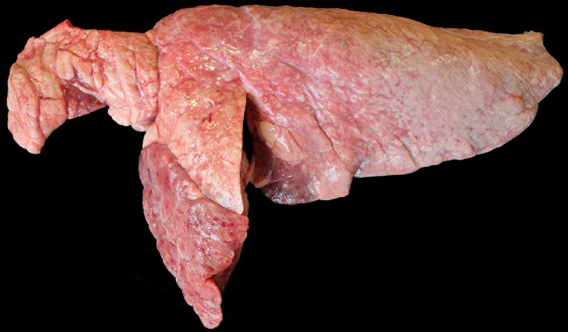 Abbildung 6: Mit M. hyopneumoniae und P. multocida koinfizierte Lunge eines Schweins. Konsolidierte kranioventrale Bereiche mit r&ouml;tlich-brauner F&auml;rbung, die im Vergleich zum restlichen Lungenparenchym erh&ouml;ht sind, was auf eine durch P. multocida verursachten L&auml;sion hindeuten k&ouml;nnte. Im Oberlappen und am kranioventralen Rand des Unterlappens finden sich r&ouml;tliche, eingedr&uuml;ckte, konsolidierte Bereiche, die zu einer durch M. hyopneumoniae verursachten L&auml;sion passen.
