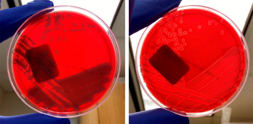 Nicht-h&auml;molytische E. coli (links) und h&auml;molytische E. coli (rechts)
