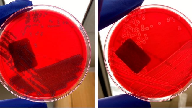 Nicht-h&auml;molytische E. coli (links) und h&auml;molytische E. coli (rechts)
