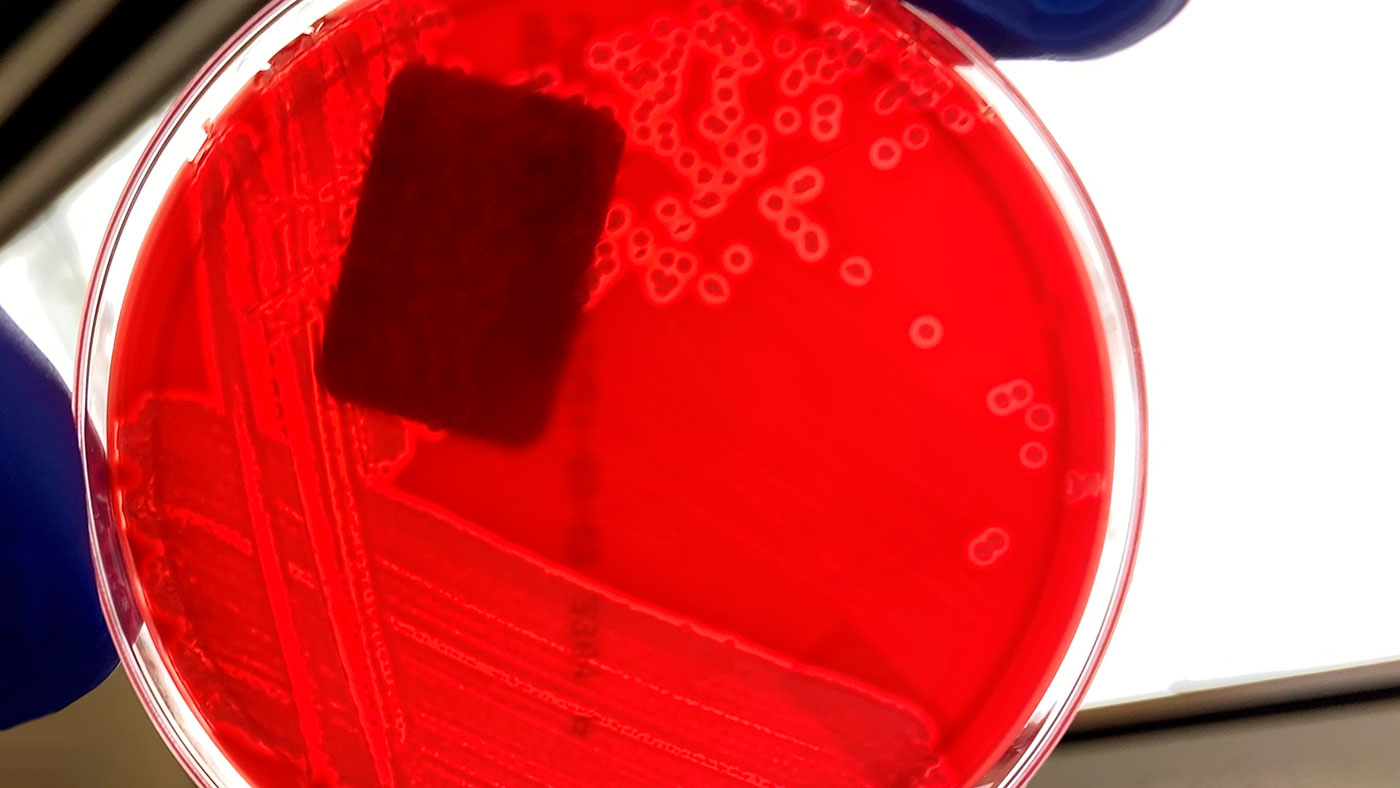 <p>Abbildung 1: Reinkultur von hämolytischen E. coli auf einer Blutagarplatte. Man beachte die hellen Bereiche um jede Bakterienkolonie, die auf eine Hämolyse hinweisen (Auflösung von Blut auf der Agarplatte). Bildnachweis: Iowa State University, Veterinärdiagnostisches Labor, Abteilung Bakteriologie</p>