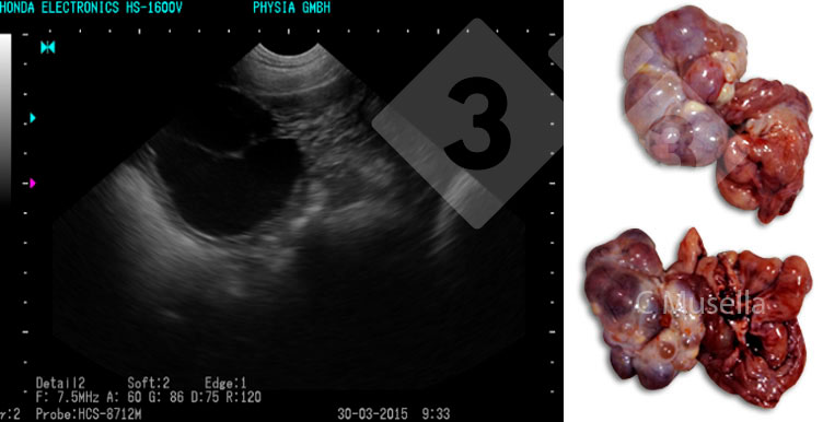 Abbildung 3: Polyzystische Ovarien
