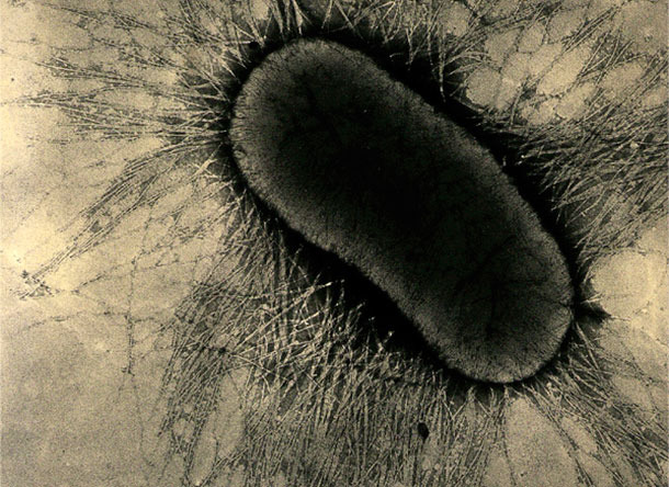 Die Adhäsionsfaktoren von ETEC sind spezialisierte Fimbrien- oder Pilusproteine, die sich an die Glykoproteinrezeptoren der intestinalen Zellen anheften.