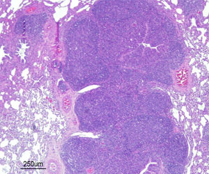 Broncho-interstitielle Pneumonie mit BALT Hyperplasie (engl. broncho-alveolar lymphoid tissue) verursacht durch eine experimentelle M.hyo Infektion 