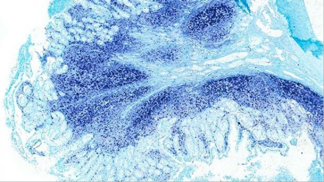 Ileum: Dasselbe Ileum des von der PCV2-bedingten systemischen Erkrankung betroffenen Schweins zeigt große Mengen des PCV2-Genoms in den Peyer-Plaques und in der Darmschleimhaut. In-situ-Hybridisierung zum Nachweis von PCV2: schnelle grüne Gegenfärbung.
