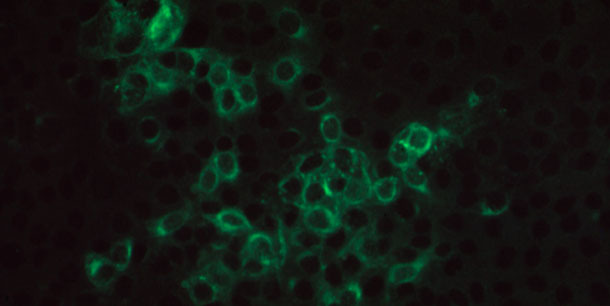 Fotomikroskopische Aufnahme positiver Immunofluoreszenz bei einer Monoschicht aus PRRSV-infizierten MARC145-Zellen, die mit einem Schweineserum inkubiert wurde, das PRRSV-spezifische IgG-Antikörper enthielt, und mit FITC-konjugierten Ziegen-Anti-Schwein-IgG-Antikörpern gefärbt wurde.