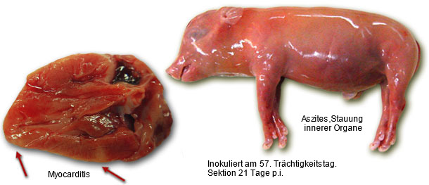 Myokarditis und Aszites